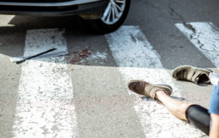 Pedestrian Accident Guide: What Happens Next